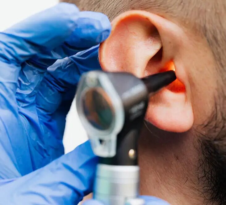 Ear Infections 101: What You Need to Know